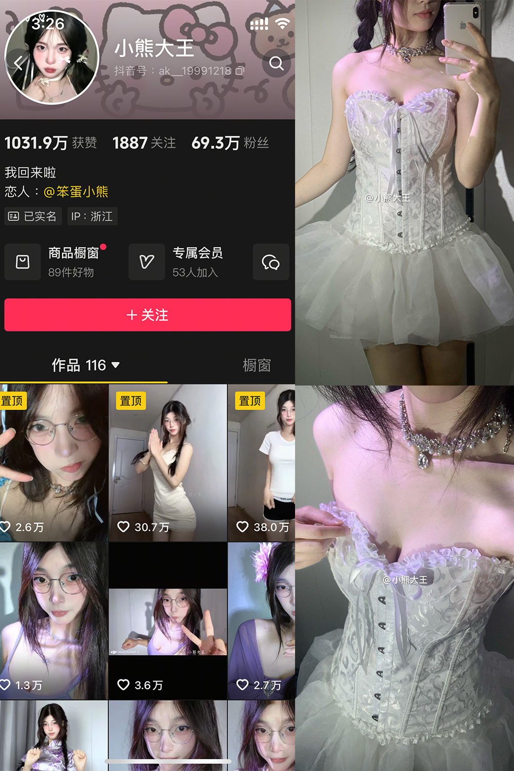 抖音 小熊大王 微密圈 001期 【32P】-漫天菊花